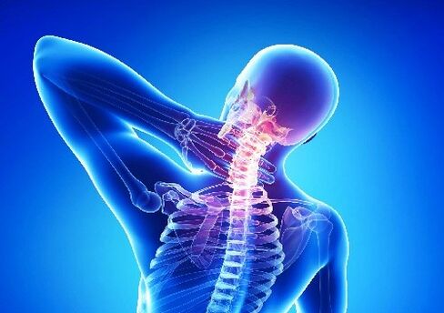 Cervical osteocondrosis